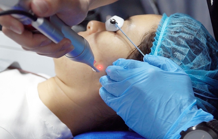 4 Different Types of Medical Lasers